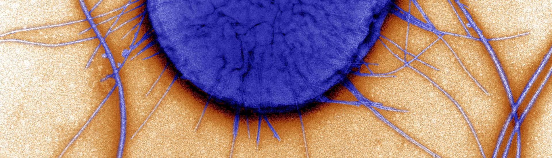 David Gregory, Debbie Marshall / Wellcome Images