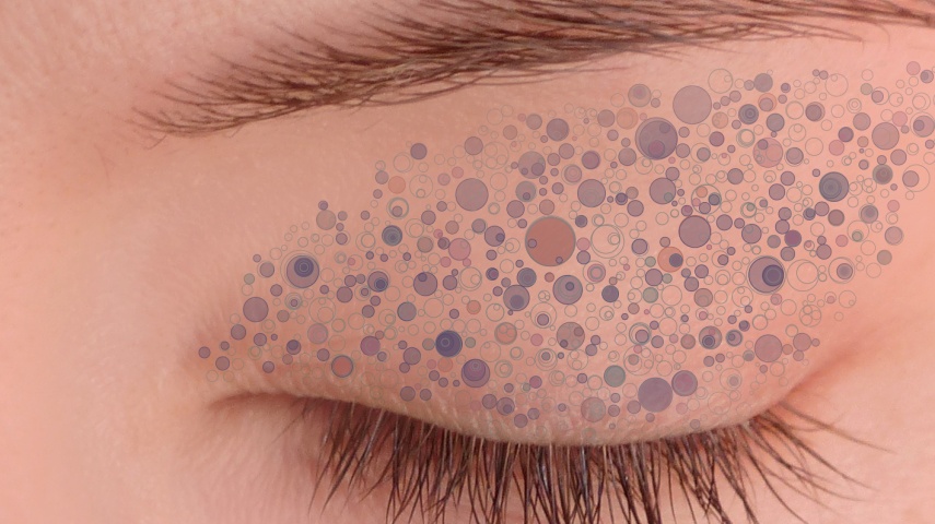 Tribes of cells carrying mutations in the eyelid Tribes of cells carrying mutations in the eyelid
